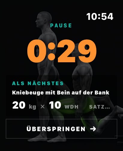 Apple Watch: Pausen-Timer